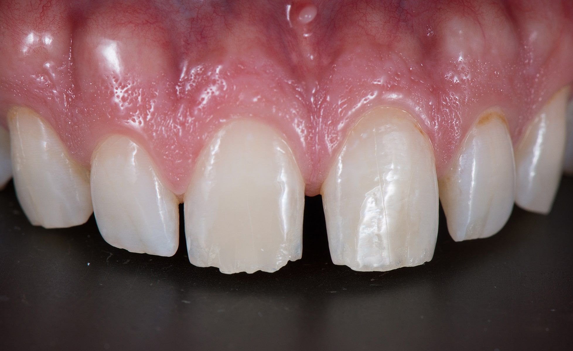 Before image