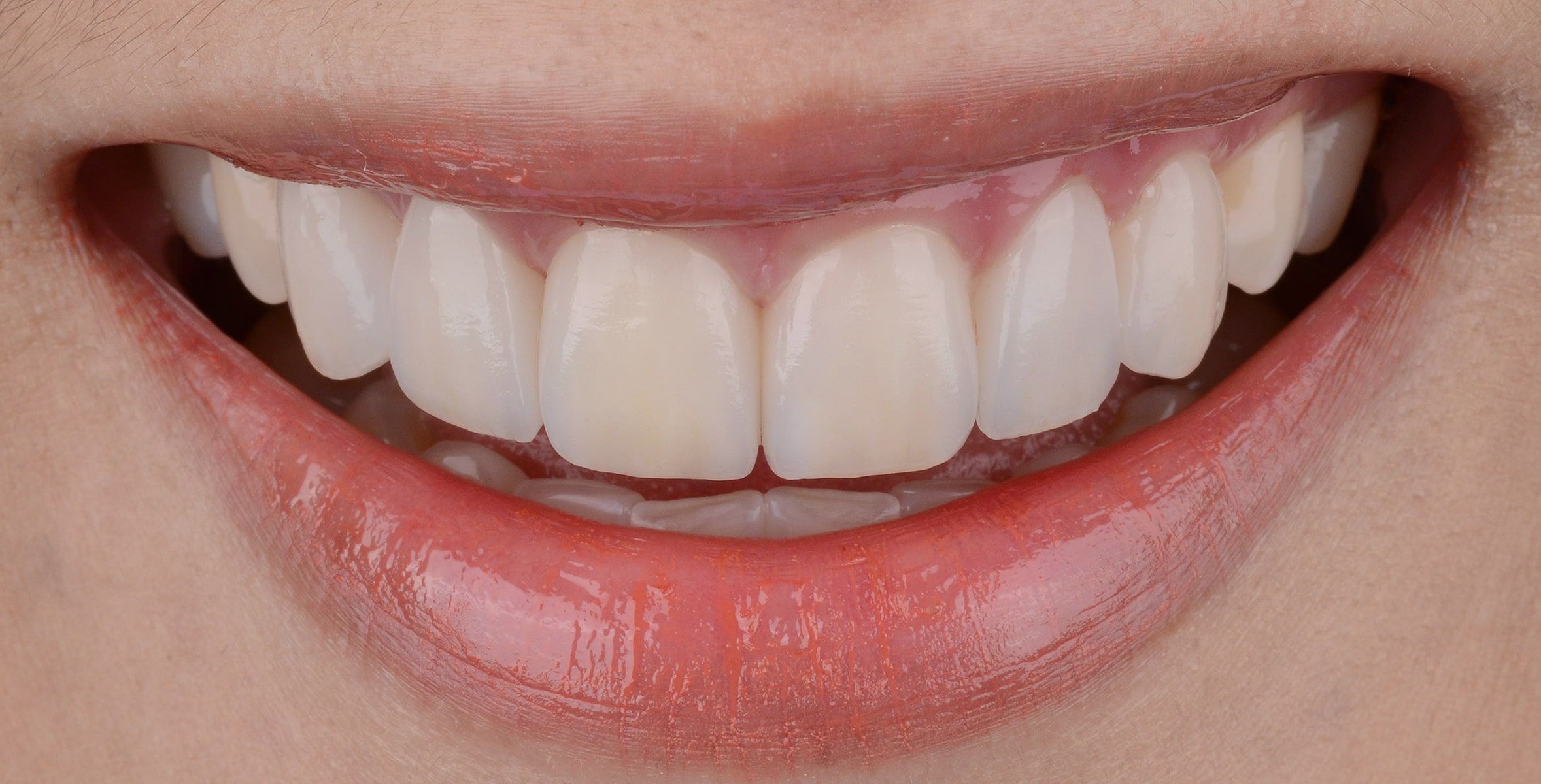 After image