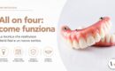 Protesi dentale fissa All on Four su impianti presso White Clinic a Bergamo