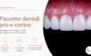Faccette dentali estetiche presso White Clinic a Bergamo