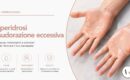 Mani con iperidrosi prima del trattamento presso White Clinic a Bergamo