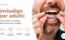 Adulto che applica una mascherina trasparente Invisalign durante un trattamento ortodontico.